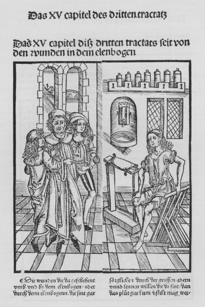 The Book of Cirurgia by Hieronymus Brunschwig by (after) German School