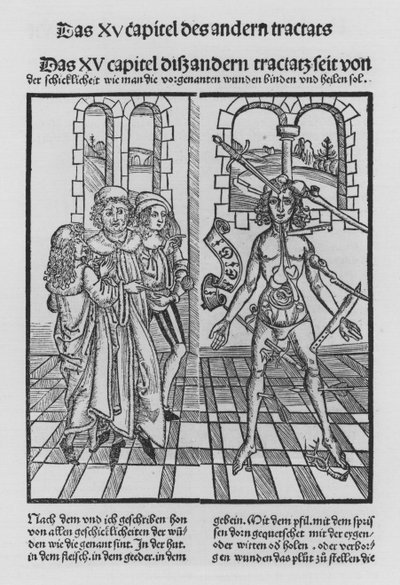 The Book of Cirurgia by Hieronymus Brunschwig by (after) German School