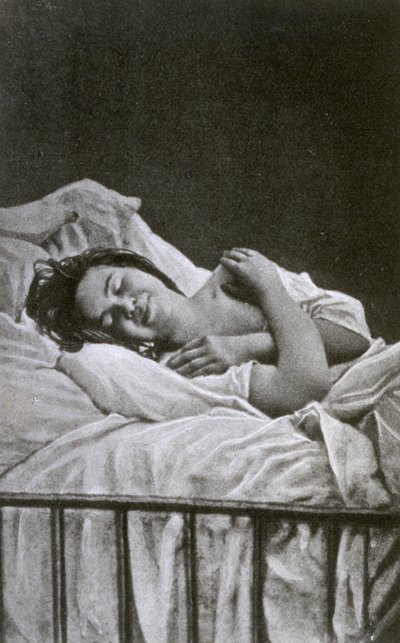 Young Woman Having a Fit of Hysteria, 1878 by Albert Londe