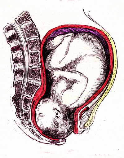 Natural or Spontaneous Childbirth by Alphonse Demarle