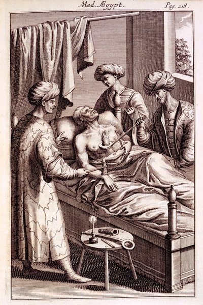 Illustration of moxibustion from Medicina Aegyptorum by Prospero Alpinus, 1745 by American School