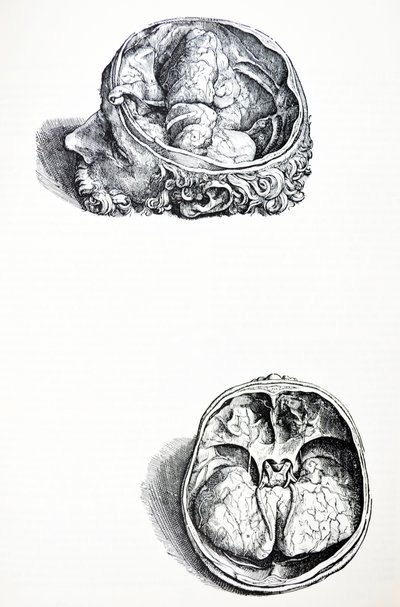 The Plates from the Seventh Book of the De Humani Corporis Fabrica by Andreas Vesalius