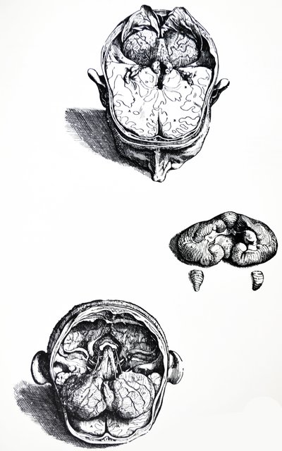 The Plates from the Seventh Book of the De Humani Corporis Fabrica by Andreas Vesalius