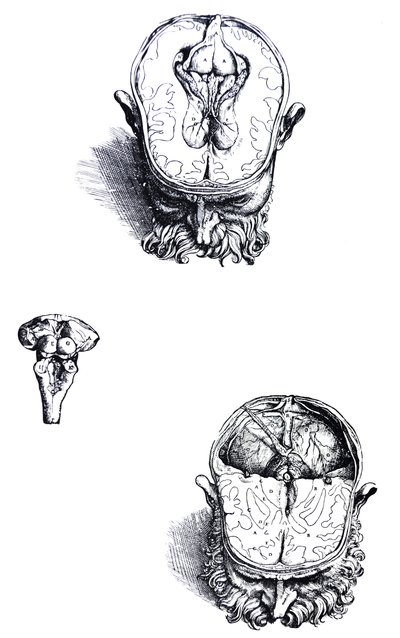 The Plates from the Seventh Book of the De Humani Corporis Fabrica by Andreas Vesalius