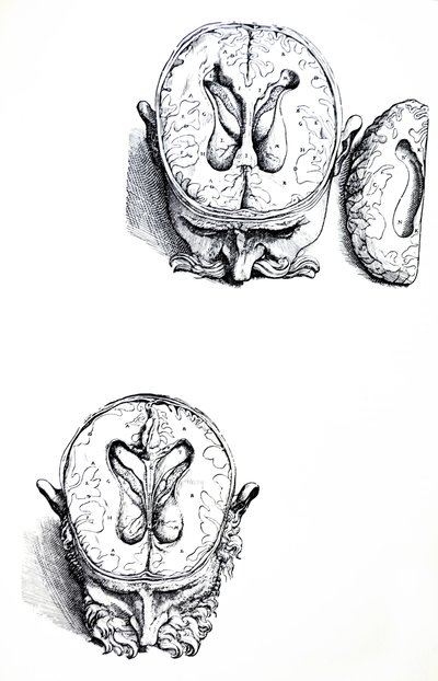The Plates from the Seventh Book of the De Humani Corporis Fabrica by Andreas Vesalius
