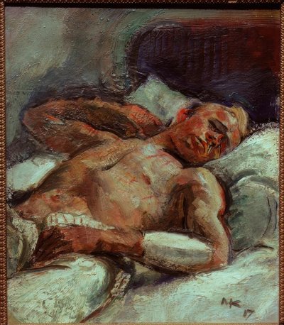 Wounded by Anton Kolig