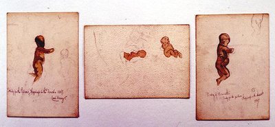 Study of a Baby for 