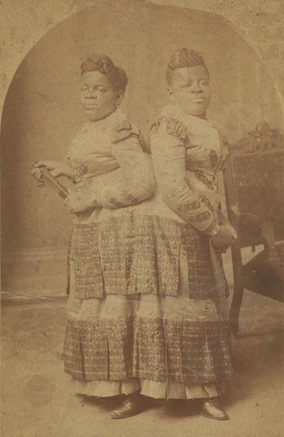 Albumen Print of Millie and Christine McCoy by Charles Eisenmann