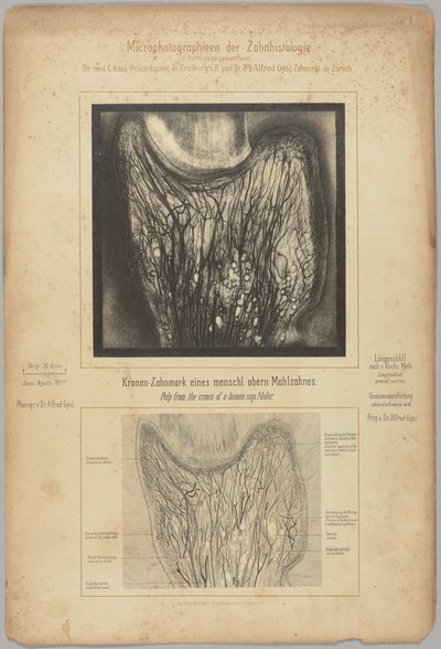 Pulp from the Crown of a Human Sup. Molar by Dr. Alfred Gysi