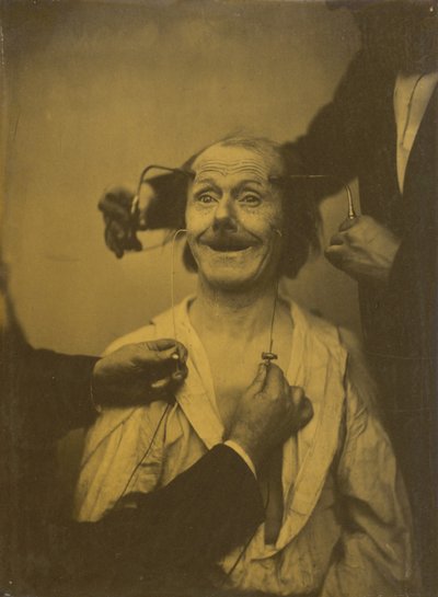 A false, incomplete expression of agreeable surprise, or admiration, 1854-1856, printed 1862 by Duchenne de Boulogne