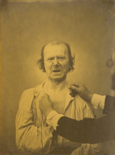 Discontent, 1854-1856, printed 1862 by Duchenne de Boulogne