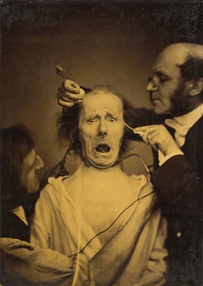 Terror Mixed with Pain, Torture by Duchenne de Boulogne