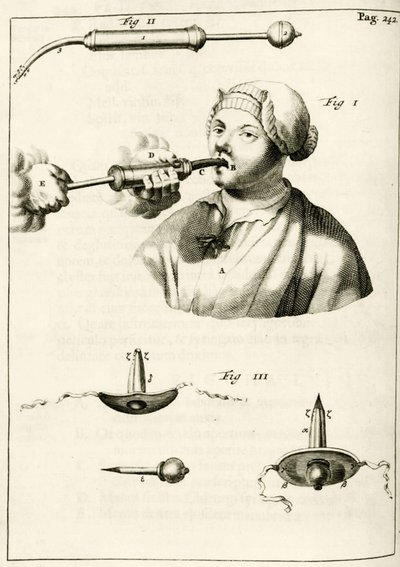 Using a syringe to deliver a purge, from Exercitationes Practicae circa Medendi Methodum by Frederik Dekkers, 1694 by Dutch School