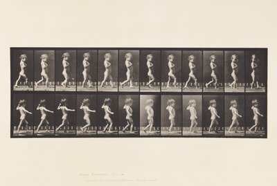 Bow Legs; Boy; Spinal Caries; Girl Walking by Eadweard Muybridge