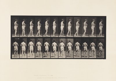 Plate 542. Multiple Cerebro-Spinal Sclerosis - Walking by Eadweard Muybridge