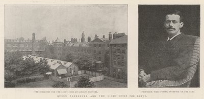 Queen Alexandra and the Light Cure for Lupus by English Photographer