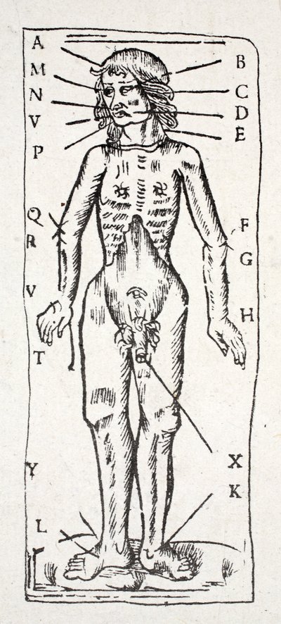 A Body Which Has Been Under the Scalpel, with Veins Labelled by English School