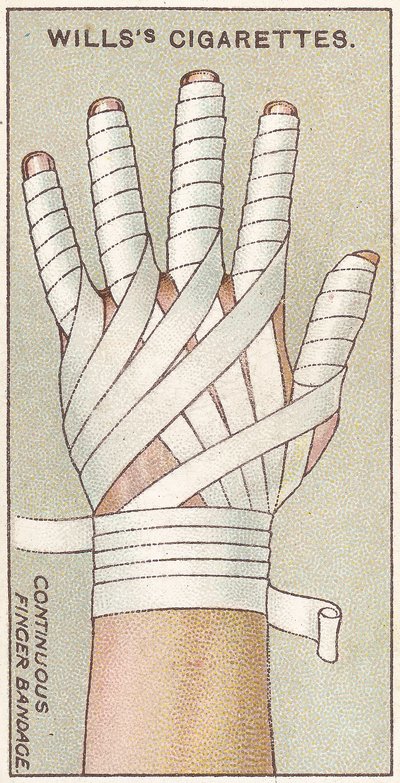Continuous Finger Bandage, no.48 from the First Aid series of Wills Cigarettes cards, 1913 by English School