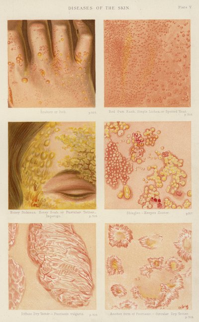 Diseases of the skin by English School