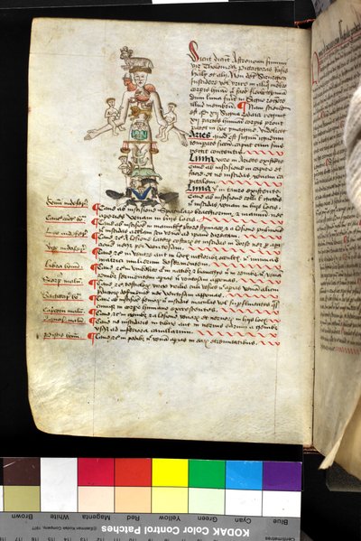 Illustration of a 