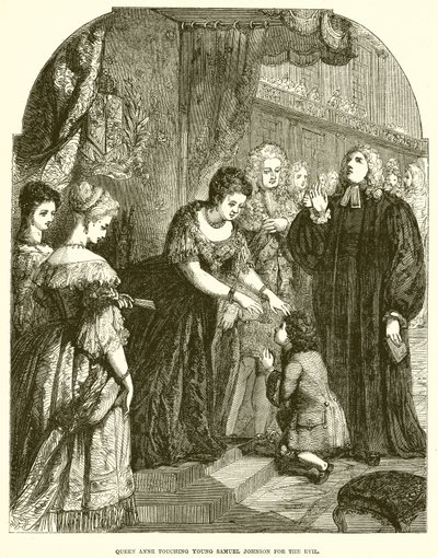 Queen Anne Touching Young Samuel Johnson for the Evil by English School