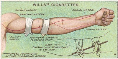 Tourniquet, no.11 from the First Aid series of Wills Cigarettes cards, 1913 by English School