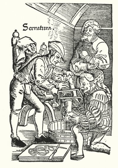 Amputation in the sixteenth century by European School