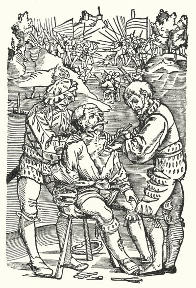 Barber surgeon removing an arrow by European School