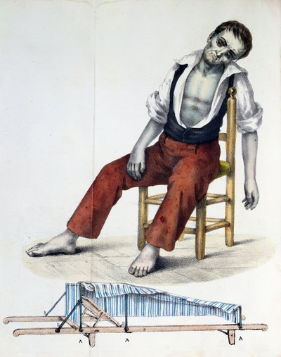 Cholera Morbus, from Relacao, Historica, Statistica e Medica da Cholera-Morbus by Francisco d