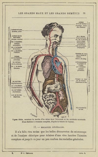 Ideal figure, showing the progression of a virus in the body and the successive accidents of a diathesis with complete evolution, according to the author