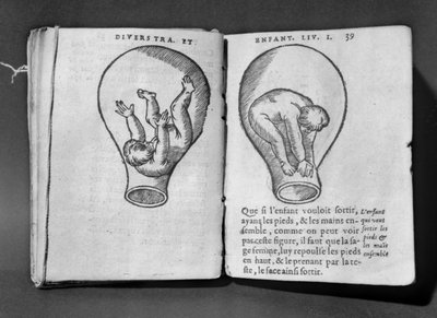 Foetus in the womb, illustration from the so-called Rhodion manuscript by French School