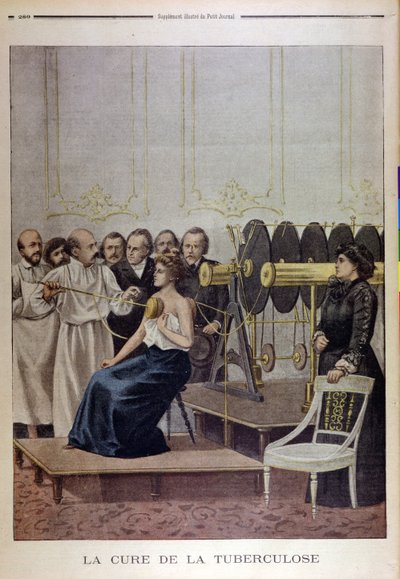 Francisque Crotte Treating a Patient with Tuberculosis using Electricity by French School
