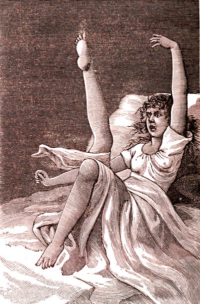 Hysteria, an extremely mental phenomenon, psychoses and psychoneurosis. 1887 by French School