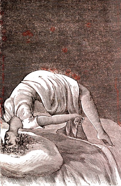 Hysteria, Mental and Nervous Disorder, Arising from Intense Anxiety. 1887 by French School