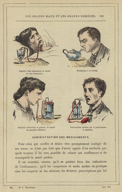Ingestion of a Medication Using a Feeding Tube, Teapot Fumigation, Balsamic and Gaseous Inhalation Using a Gasogene Inhaler, Reactive Spraying by the Reaction Sprayer by French School
