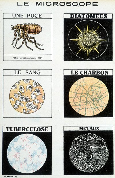 Microscopes: A Chip, Diatoms, Blood, Coal, Tuberculosis, Metals by French School