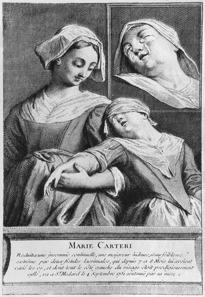 Miraculous healing of a blind woman, Marie Carteri, on the tomb of Deacon Francois de Paris at the parish cemetery Saint-Medard in Paris by French School