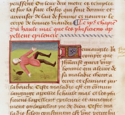 Patient suffering from an epileptic fit, from Le Livre des Proprietes des choses by Barthelemy l