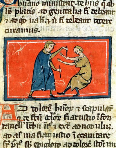 Doctor cauterising a wound with fire, from an edition of Book of Surgery by Rogier de Salerne by French School