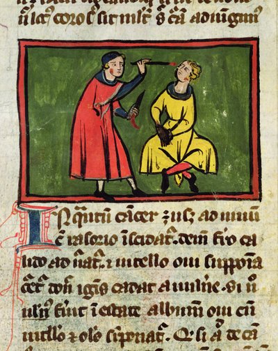 Surgical Treatment (from an edition of Book of Surgery by Rogier de Salerne) by French School