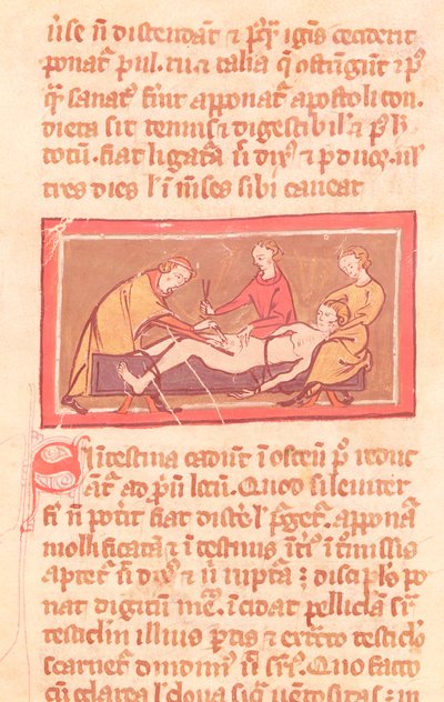 Surgery, from an edition of the Book of Surgery by Rogier de Salerne by French School