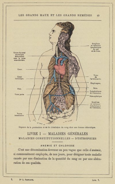 Organs of Blood Production and Circulation in a Chlorotic Woman by French School
