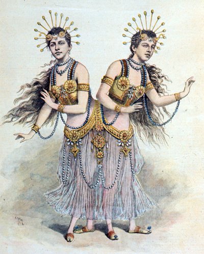 Siamese Twins, Rosa - Josepha Blazek from 