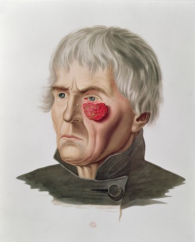 Skin Disease Before an Operation, from Selecta Praxis Medico-Chirurgica by Alexander Auvert by French School
