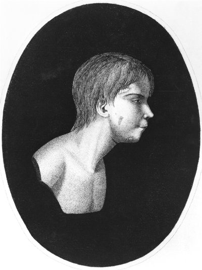 Victor of Aveyron, Frontispiece of De l