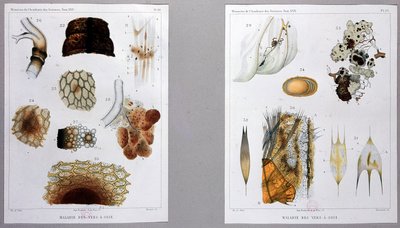 Work on Silkworm Disease Presented by Pasteur at the Academy of Sciences by French School