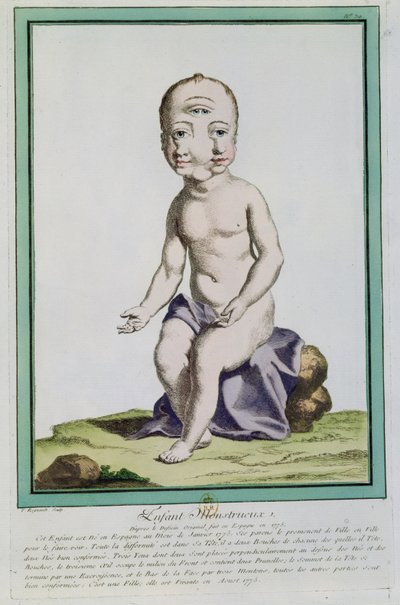 Child with a Deformed Head, from 