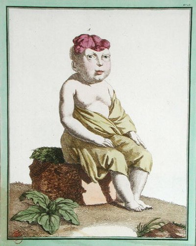 Child with half a head, from 