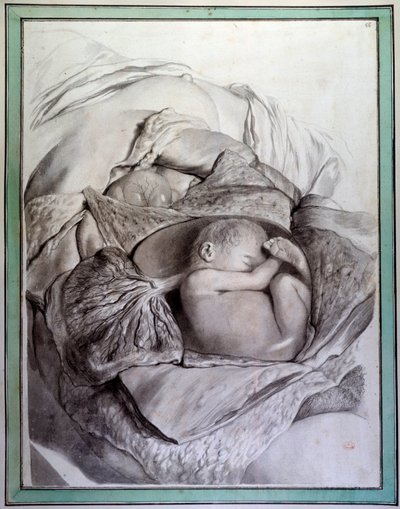 Representation of a Fetus of a Human Being in a Uterus by Gerard de Lairesse