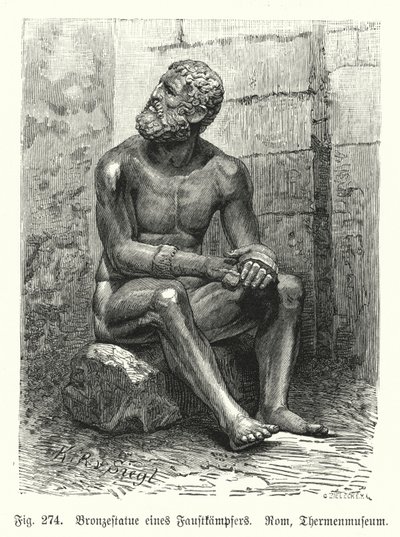 Ancient Greek or Roman Bronze Statue of a Seated Boxer by German School